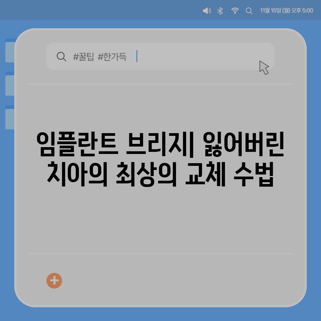 임플란트 브리지| 잃어버린 치아의 최상의 교체 수법